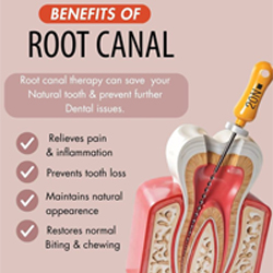 Root Canal Treatment in Vadodara 